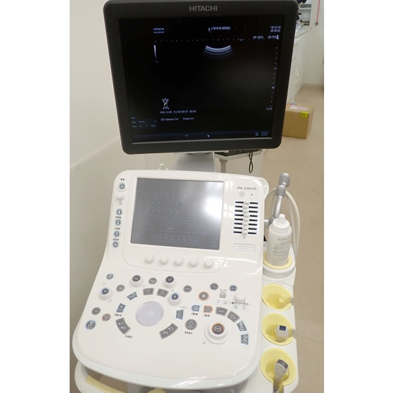 超音波診断機
